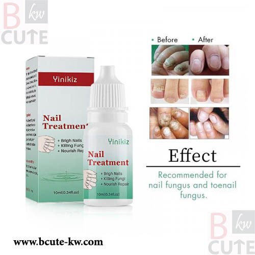 Yinikiz Nail Oil Nail Liquid Repair Treatment 10ML