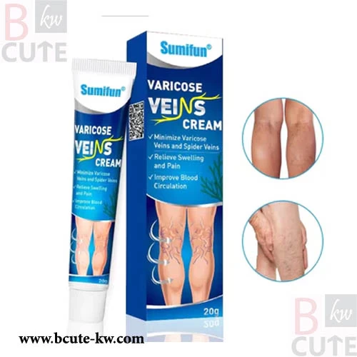 Varicose Veins Cream | Herbal Cream for Spider Veins