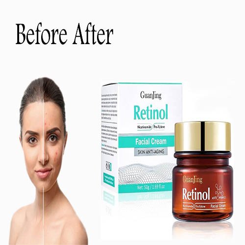 42fed97d-cf3f-436b-8a02-0fda1d3f1c52.__CR0,0,970,600_PT0_SX970_V1___