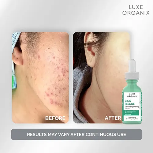 luxeorganix-cicarescue-serum-binibeauty-3