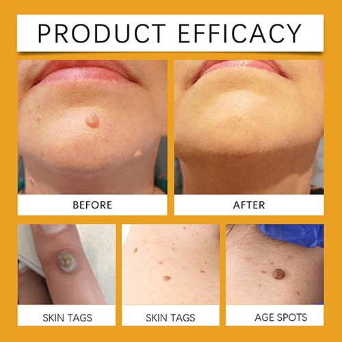 612olQqrKjL._AC_SL1500_