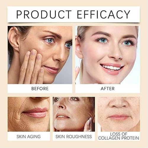 Ouhoe Botox Bee Venom Erase Lines And Wrinkles 30 ml Ouhoe Botox Bee Venom Erase Lines And Wrinkles 30 ml