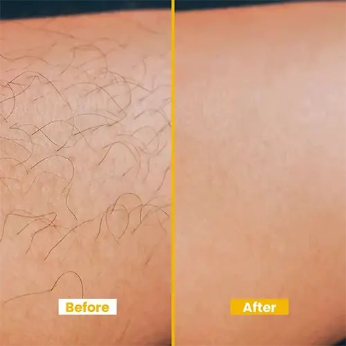 Before_and_after_5e2c88c3-ed1c-4cff-aff0-76b5cfe55085