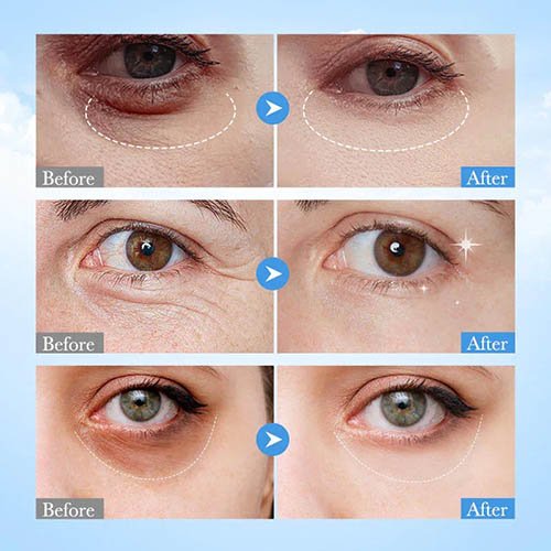 download_25_890ceb26-70d1-485e-88ad-4277d280540c