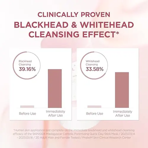 71-EKwRmIGL._SX522_bd83f266-0f6c-4ee5-89e9-d75437af0e10