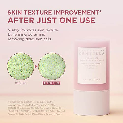 71lwT1npHgL._SX522_d2442e25-2516-455d-aeb6-6897cd499683