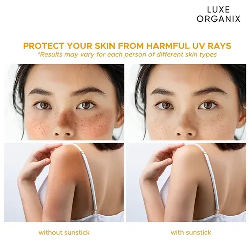 ph-11134207-7rash-m620nzv0a4jyd4