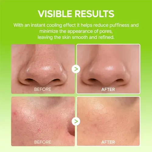 819oBIw5FLL._SL1500 Dr.Melaxin - Cactox Pore Relief Multi Balm 25gm - Image 2