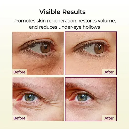 Dr.Melaxin_calcium_multi_balm_for_under-eye_firming_and_dark_circles Dr.Melaxin Cemenrete Calcium Volume Multi Balm 9g - Image 2