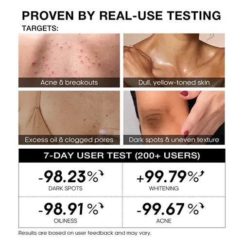 5_d32deb26-b462-4c57-ba61-f6c13158eea0 Teashell Niacinamide Skin Brightening Soap – 100g - Image 3